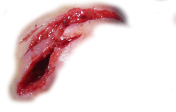 Scar PNG-15754